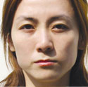 <b>改脸型前后对比照</b>