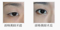 我的派特美眸日记