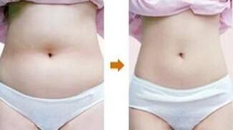 腹部吸脂手术