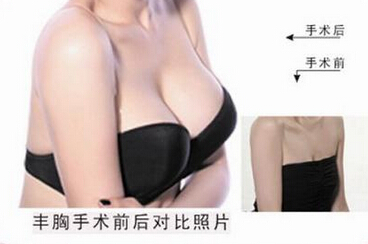 持久丰胸的方法是什么