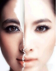 彩光嫩肤美白有哪些好处