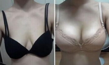 32岁的女人胸部还能变大吗?