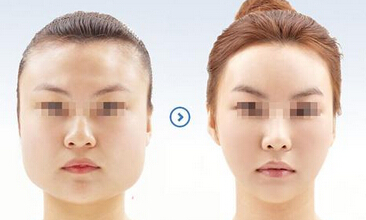 怎样把圆脸变鹅蛋脸