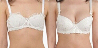 乳房发育不良怎么补救