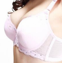 乳晕大怎么回事