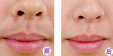 胡须多怎么办