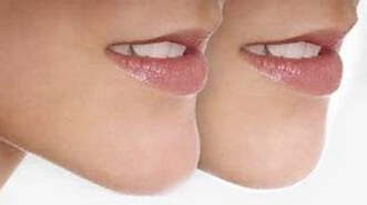 硅胶垫下巴如何呢