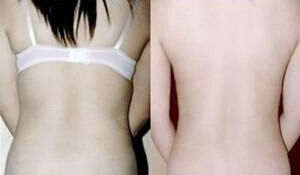 背上肉多怎么办才好