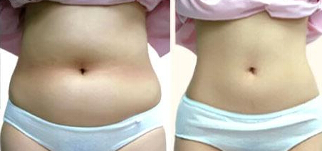 如何拥有杨柳细腰