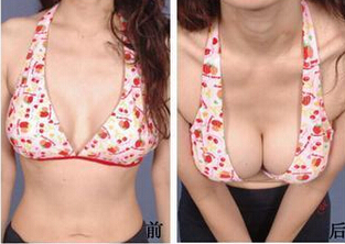 成美艾菲尔丰胸好吗