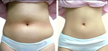 女生减肥很难吗