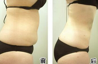 腹部的赘肉如何减