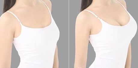 快速丰满乳房的方法是什么