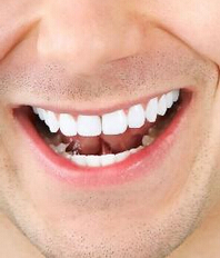 牙齿黄黑怎么办