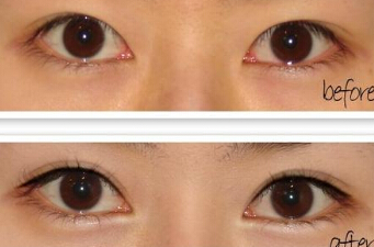 不化妆如何让眼睛变大