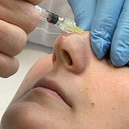 注射隆鼻是否影响鼻子的功能