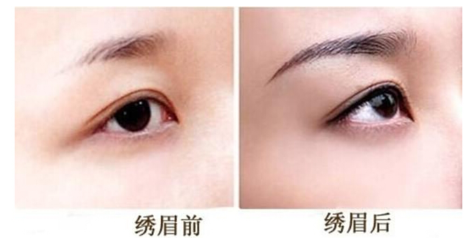 绣眉